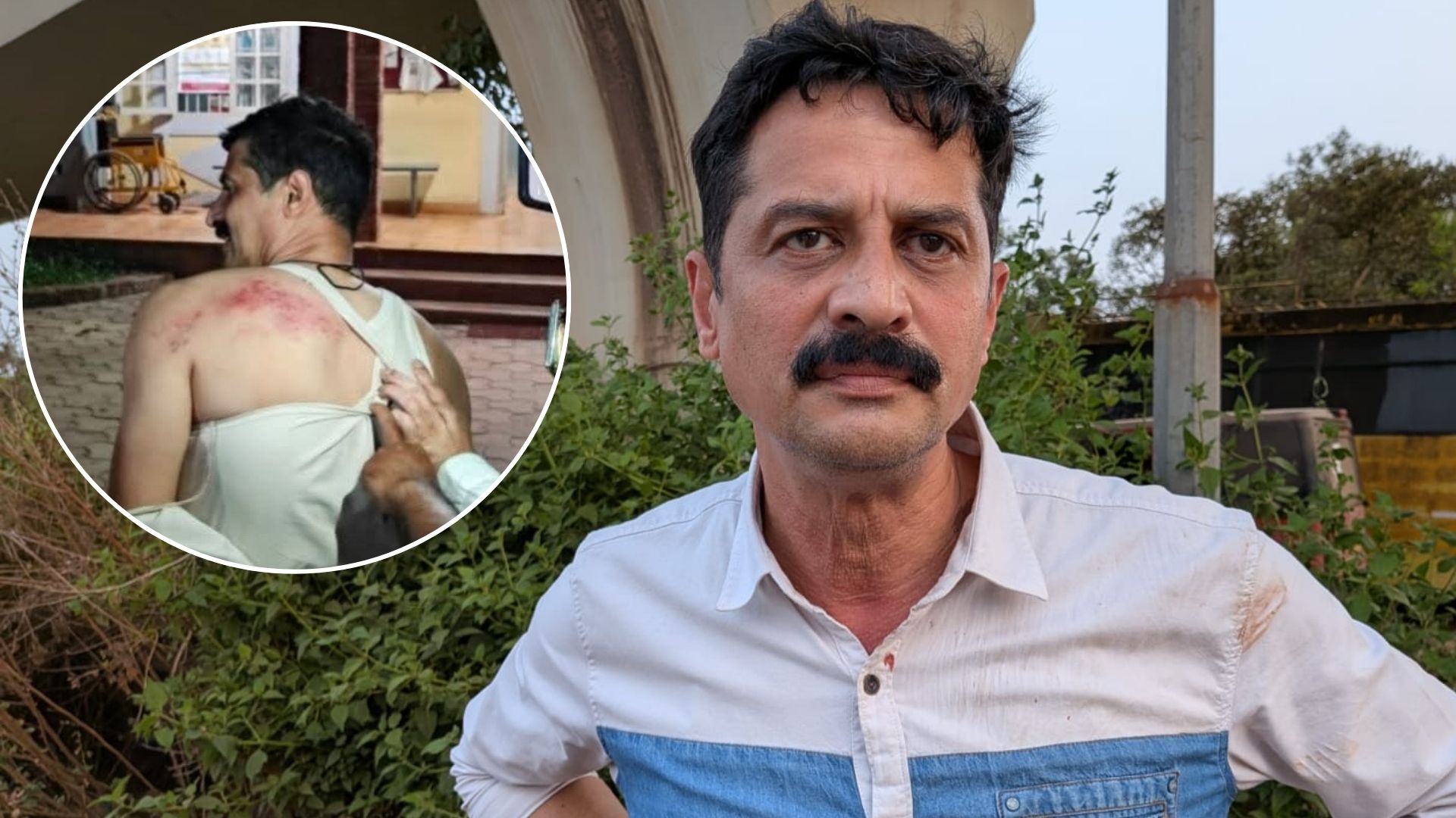 Yogesh Tigade arrested over alleged attack on activist Kashinath in Merces case