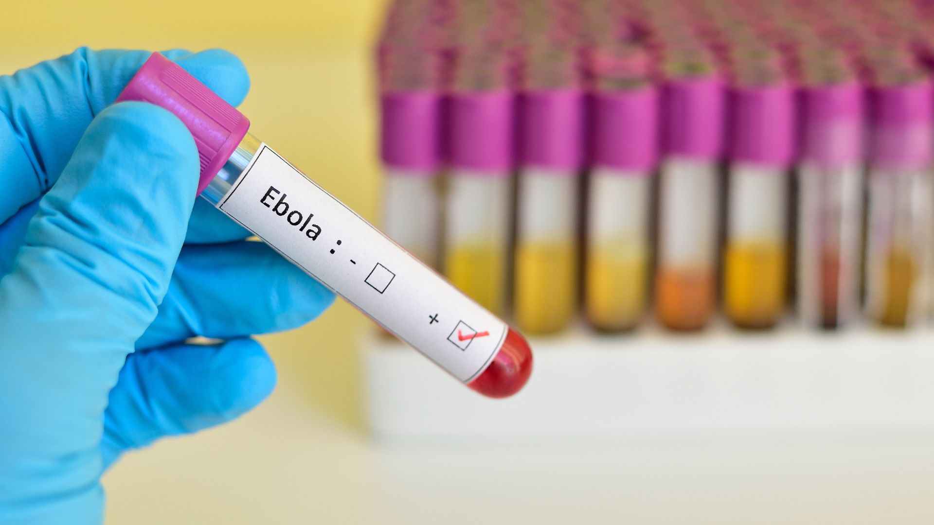 Goa firm develops Ebola detection test