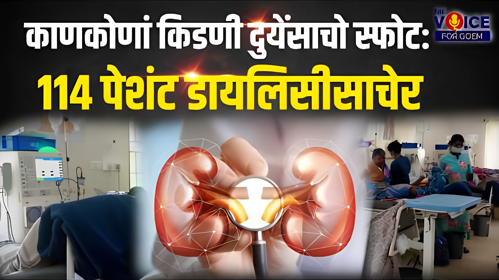 Kidney-related deaths: काणकोणां किडणी दुयेंसाचो स्फोट: 114 पेशंट डायलिसीसाचेर